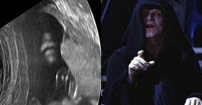 Ada Penampakan Tokoh Star Wars Kaisar Palpatine di Hasil USG