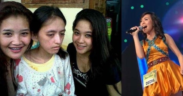 Foto decha stardut meninggal 2 Foto decha stardut meninggal 27